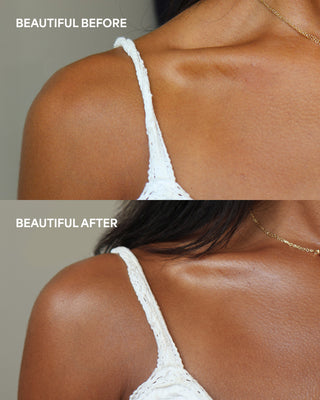 Before and after comparison of a woman's shoulder and neck area with a white lace top.