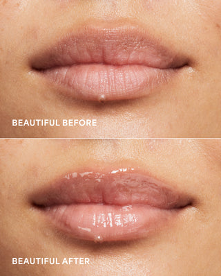 Peptide Lip Treatment