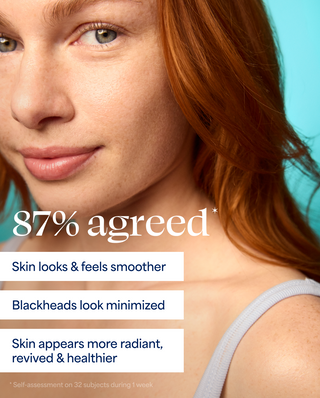 Woman with red hair and a blue background, featuring text about skin improvement.